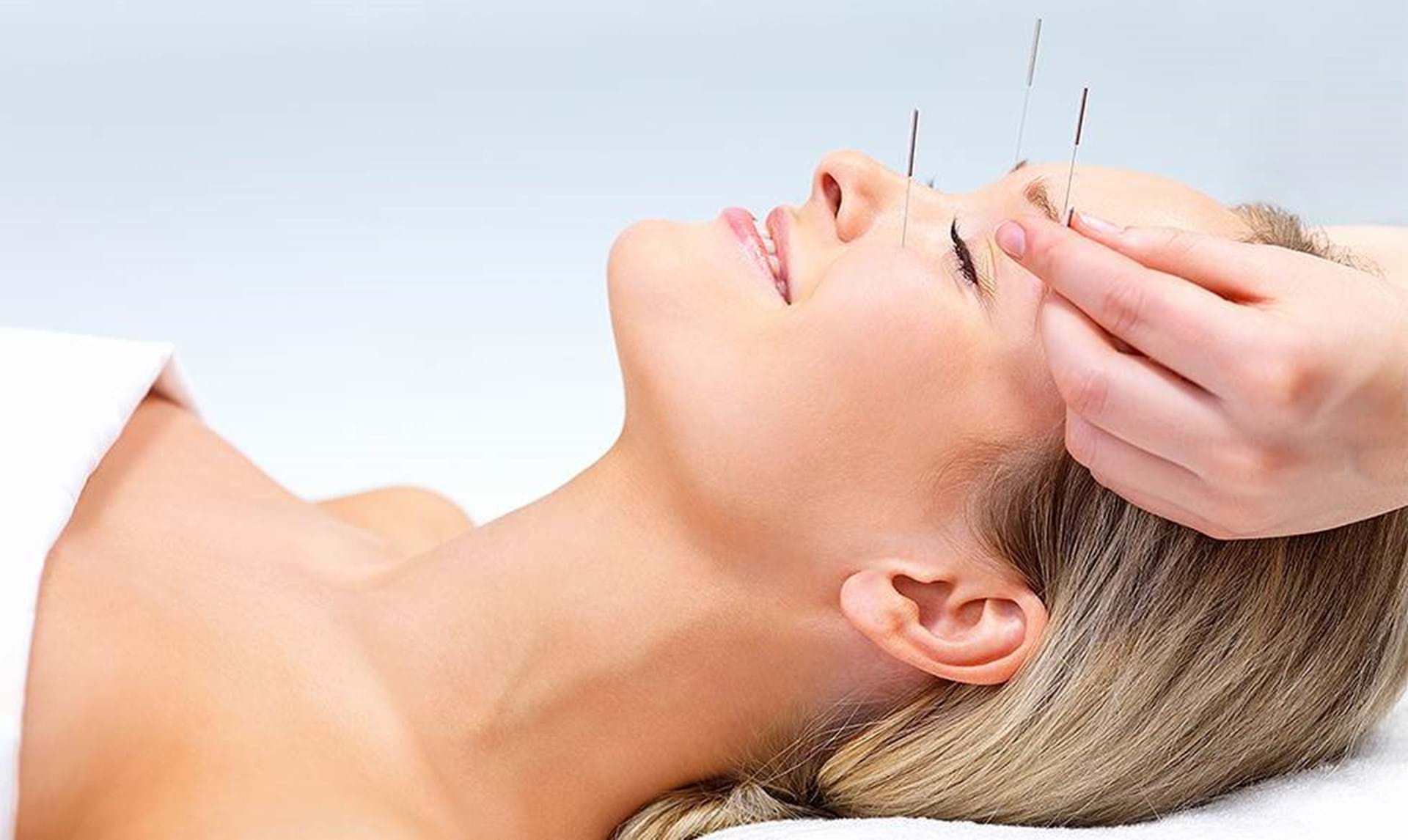 Akupunktur: Hvad er det, og hvordan virker akupunktur? -